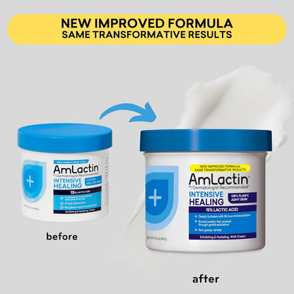 AmLactin Intensive Healing Body Cream: 2-in-1 Exfoliator and Moisturizer with 15% Lactic Acid and Ceramides – 12 oz Tub for 24-Hour Moisturization