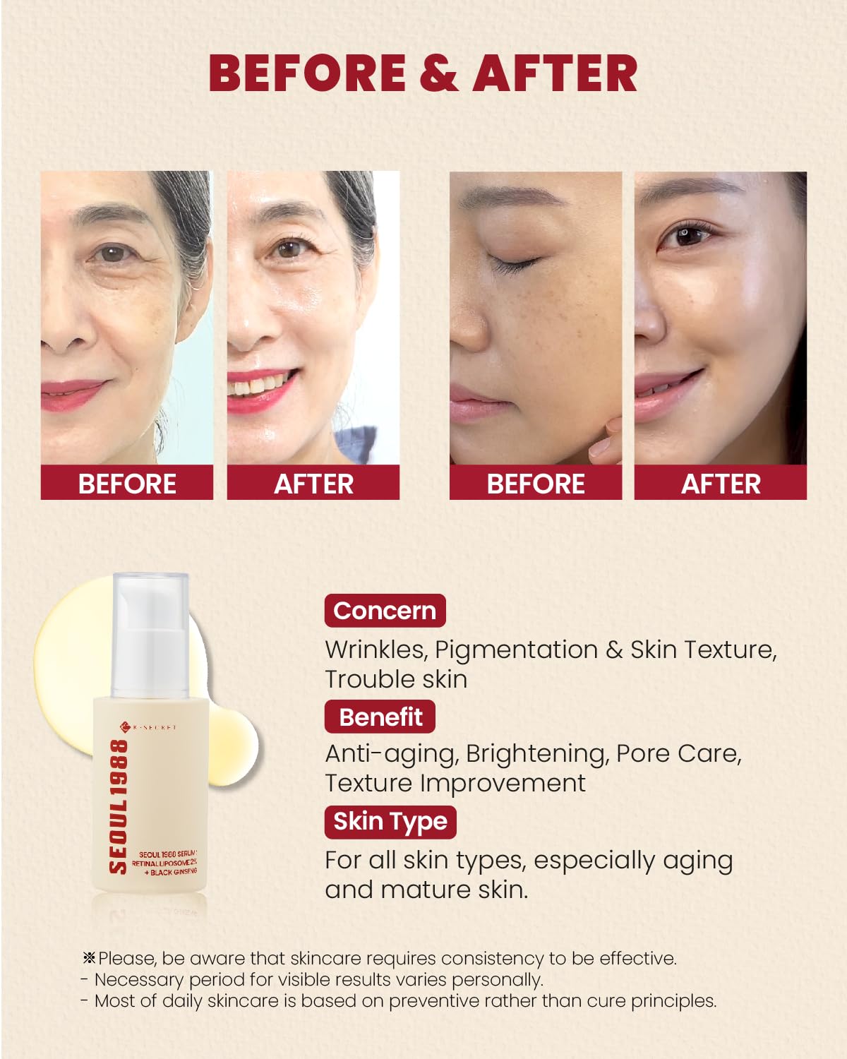 KSECRET SEOUL 1988 Serum, 30ml (1.01 fl. oz.) – Retinal Liposome 2% + 58% Black Ginseng Extract with Bakuchiol, Vitamin C & 3 Peptides for Wrinkle Care – Korean Skincare