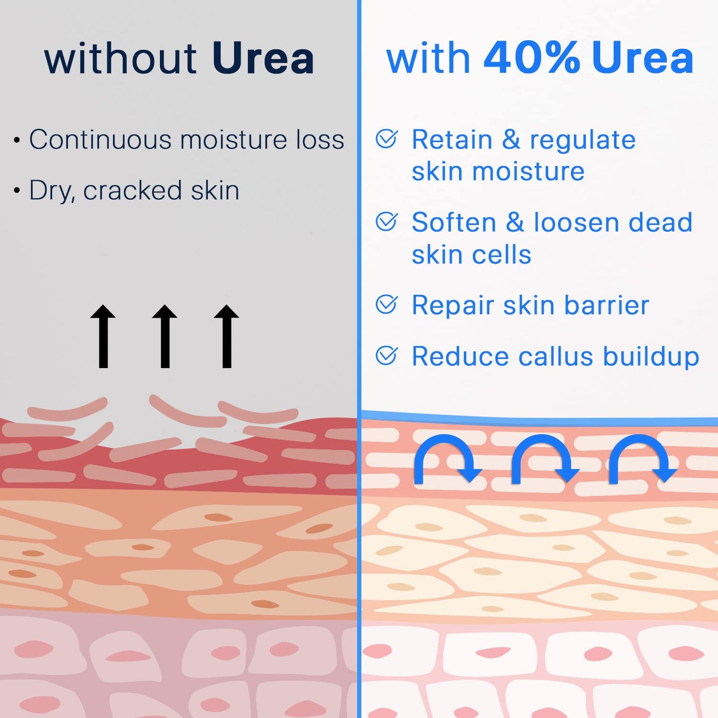 Ebanel Urea Cream 40% + Salicylic Acid 2%, Foot & Skin Repair Cream for Dry Cracked Heels, Feet, Knees, Elbows, and Hands | Dead Skin, Callus, and Toenail Softener, Keratolytic Skin Barrier Repair