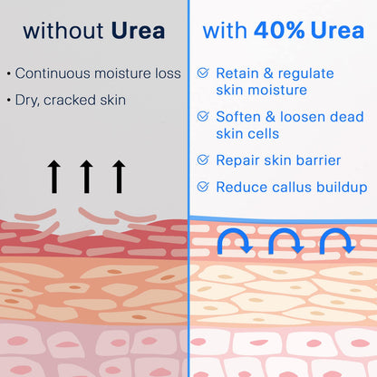 Ebanel Urea Cream 40% + Salicylic Acid 2%, Foot & Skin Repair Cream for Dry Cracked Heels, Feet, Knees, Elbows, and Hands | Dead Skin, Callus, and Toenail Softener, Keratolytic Skin Barrier Repair