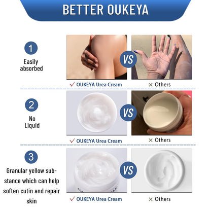 Urea Cream 40% - Intensive Foot & Hand Cream for Dry, Cracked Skin, Maximum Strength Urea Lotion for Feet