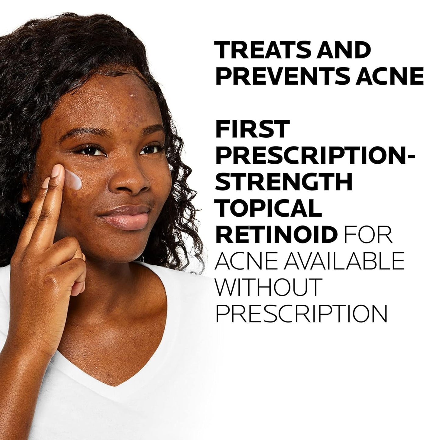 La Roche-Posay Effaclar Adapalene Gel 0.1% Acne Treatment | Retinoid Acne Cream for Blackheads & Whiteheads | Oil-Free Acne Medication