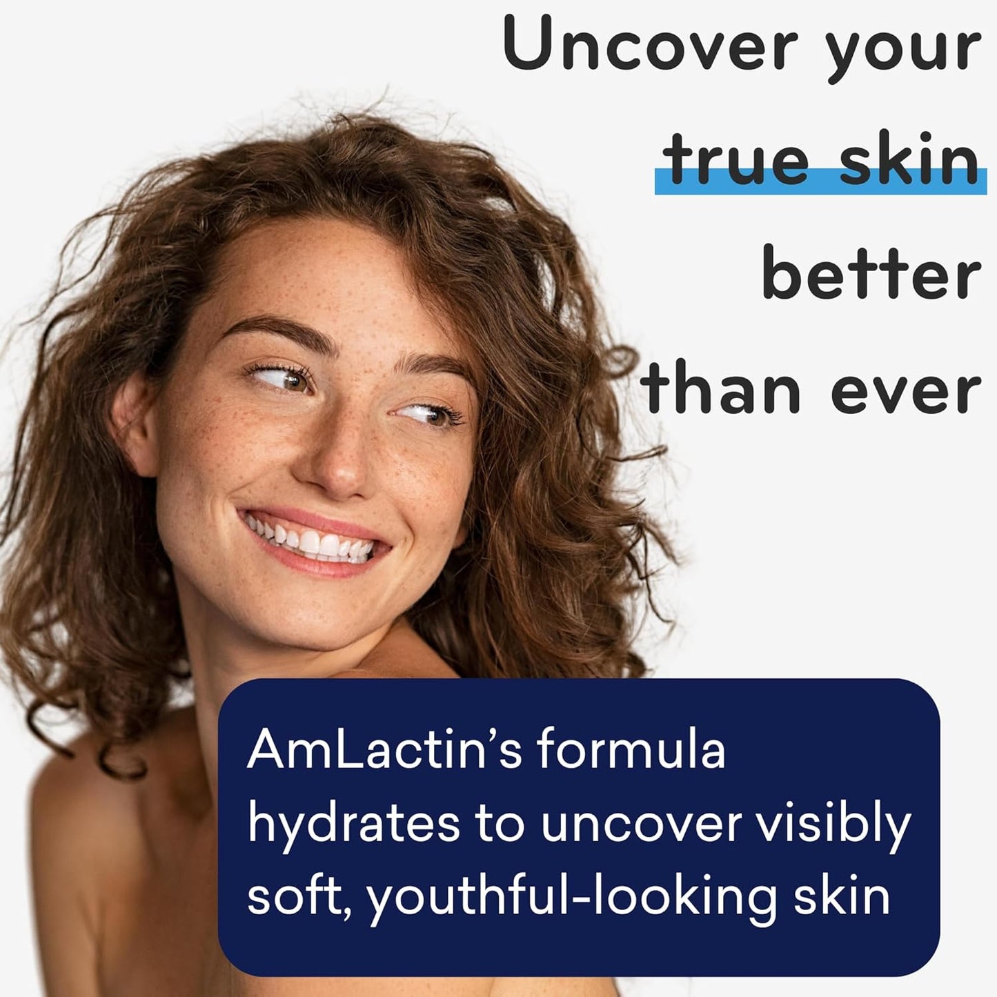 AmLactin Intensive Healing Body Cream: 2-in-1 Exfoliator and Moisturizer with 15% Lactic Acid and Ceramides – 12 oz Tub for 24-Hour Moisturization